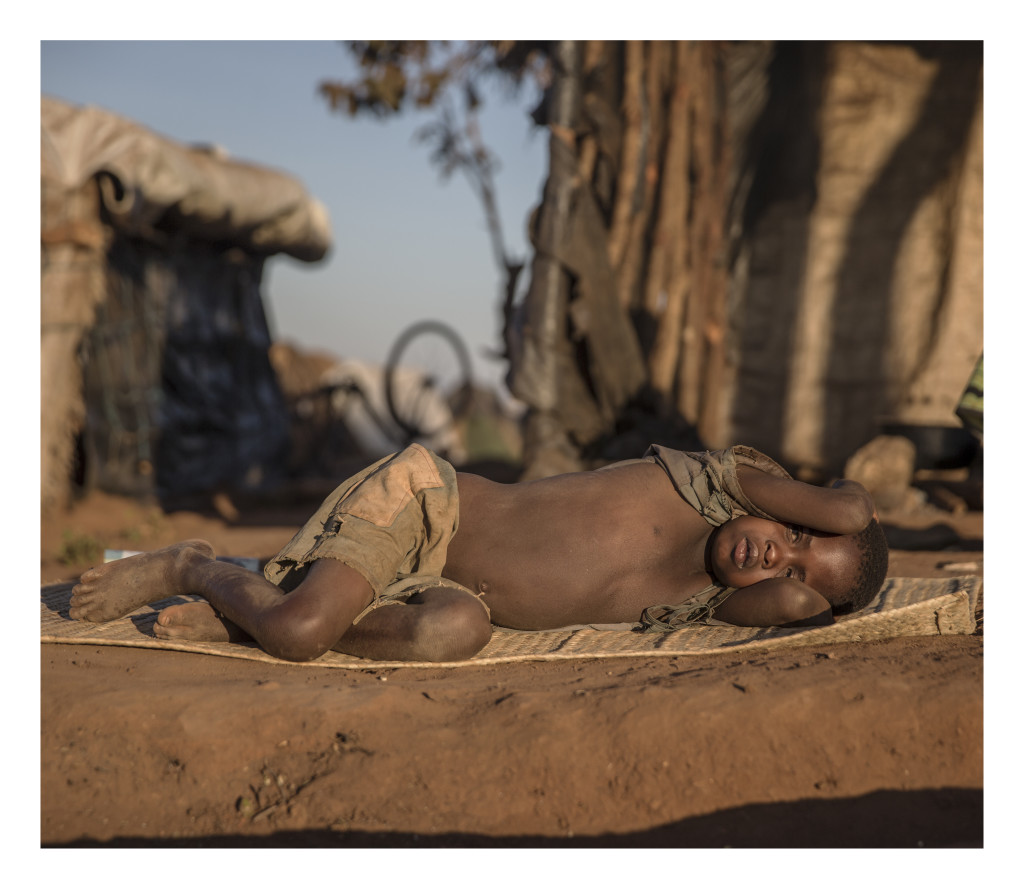 Malawi är ett av värdens fattigaste länder och extremt utsatt för klimatförändringar med torka och översvämningar. Samtidigt flyr människor in till landet från konflikter i grannländerna, framför allt från Mocambique. Situationen är också extrem för de många albinos som finns i landet de hotas av att bli mördade då deras ben och hud tros ha helande berikande krafter.